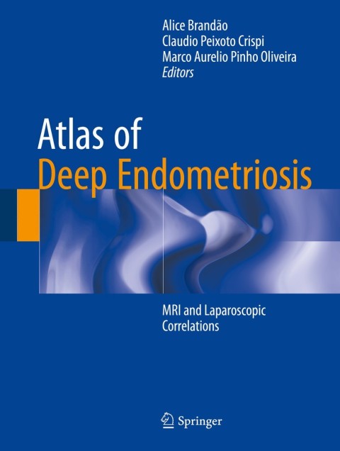 Cover image for book Atlas of Deep Endometriosis