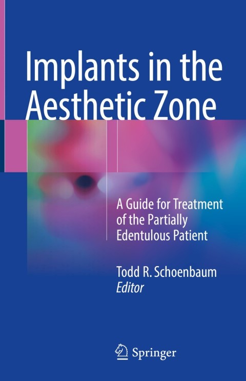 Cover image for book Implants in the Aesthetic Zone