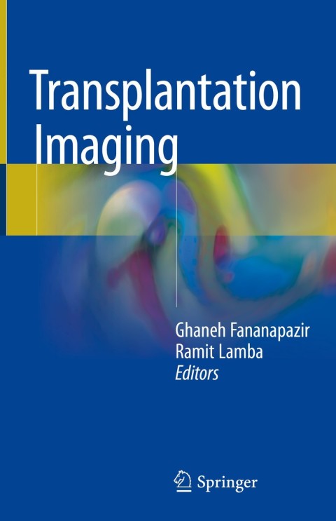 Cover image for book Transplantation Imaging