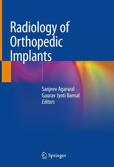 Cover image for book Radiology of Orthopedic Implants