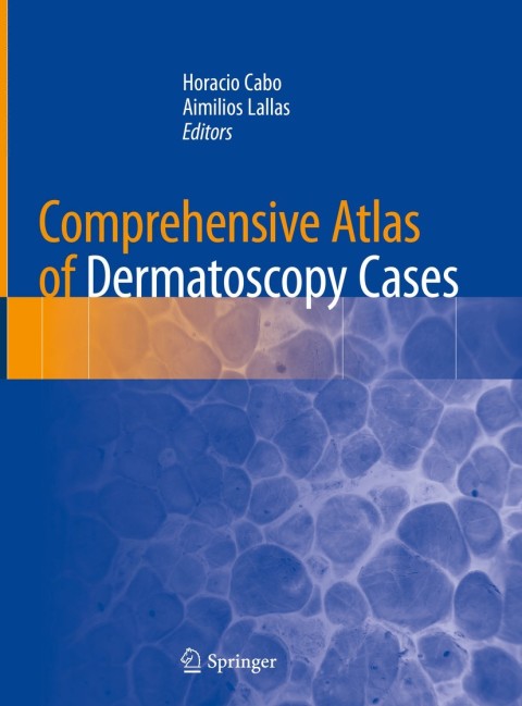 Cover image for book Comprehensive Atlas of Dermatoscopy Cases