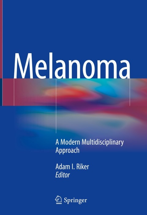 Cover image for book Melanoma