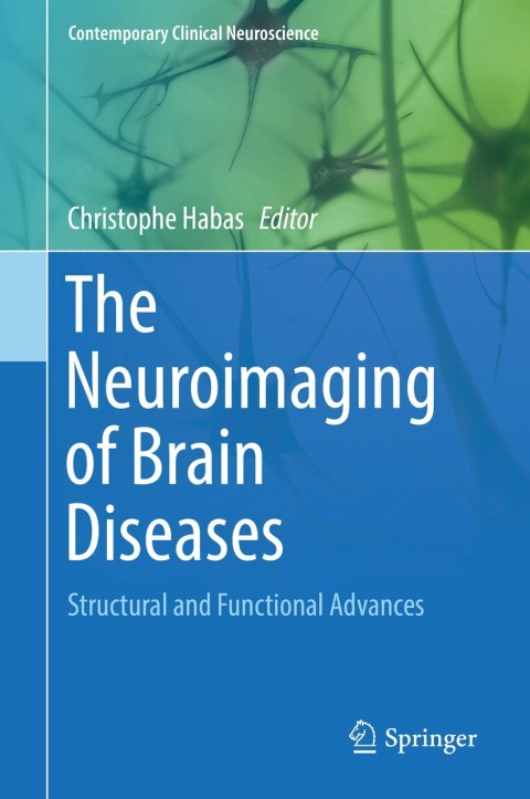 Cover image for book The Neuroimaging of Brain Diseases
