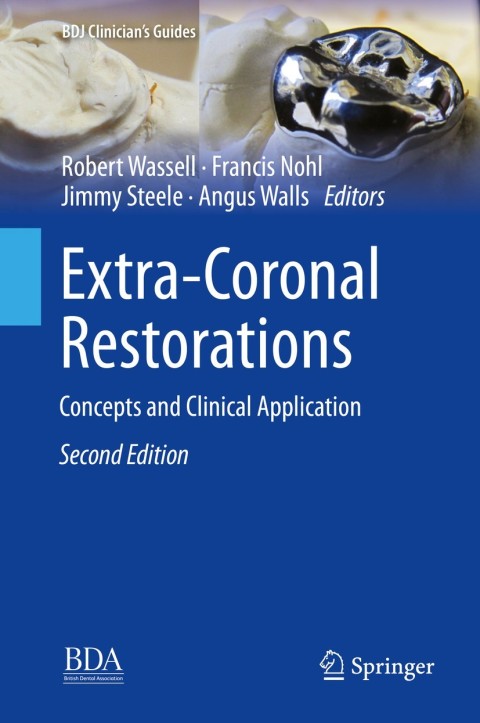 Cover image for book Extra-Coronal Restorations