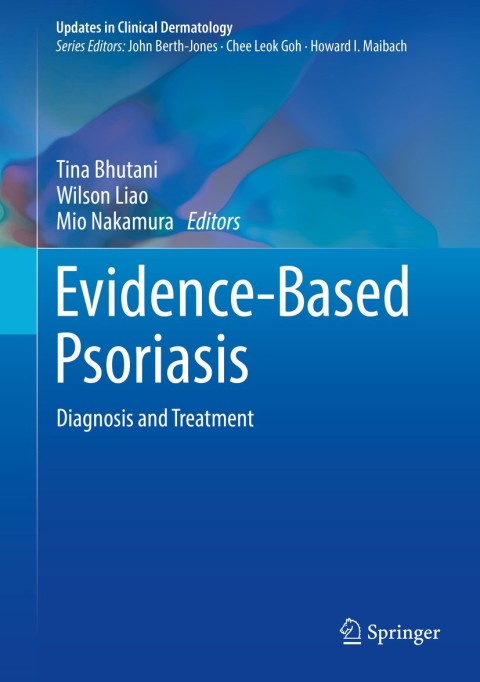 Cover image for book Evidence-Based Psoriasis