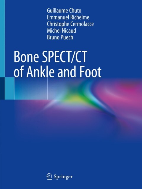 Cover image for book Bone SPECT/CT of Ankle and Foot