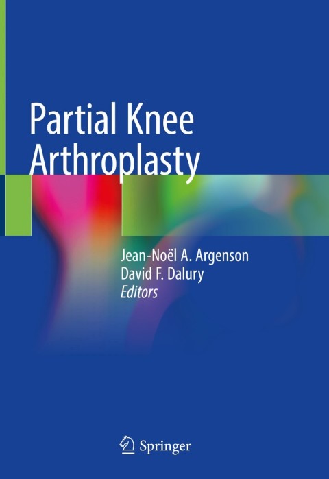 Cover image for book Partial Knee Arthroplasty