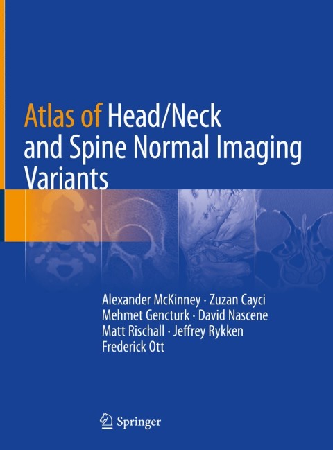 Cover image for book Atlas of Head/Neck and Spine Normal Imaging Variants