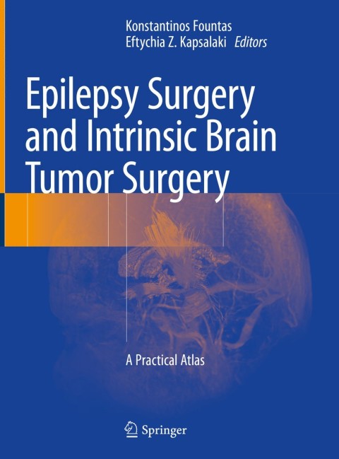 Cover image for book Epilepsy Surgery and Intrinsic Brain Tumor Surgery
