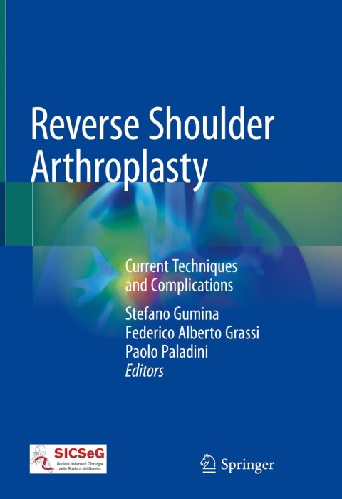 Cover image for book Reverse Shoulder Arthroplasty