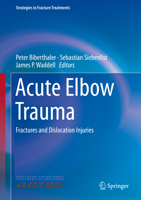 Cover image for book Acute Elbow Trauma
