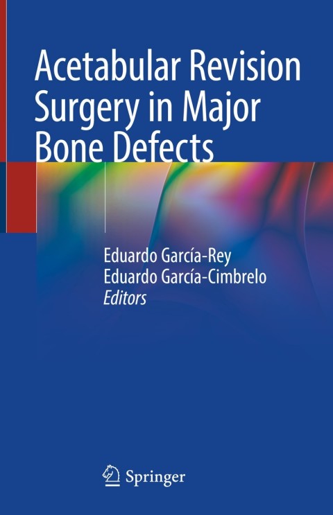 Cover image for book Acetabular Revision Surgery in Major Bone Defects