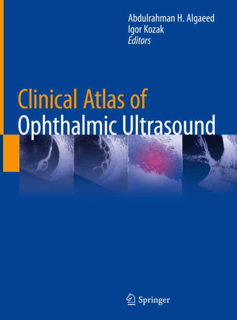 Cover image for book Clinical Atlas of Ophthalmic Ultrasound