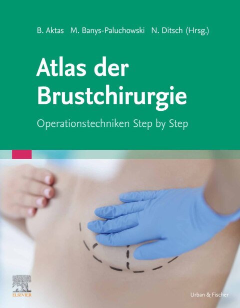 Cover image for book Atlas der Brustchirurgie