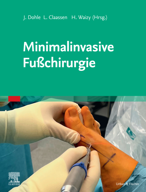 Cover image for book Minimalinvasive Fußchirurgie