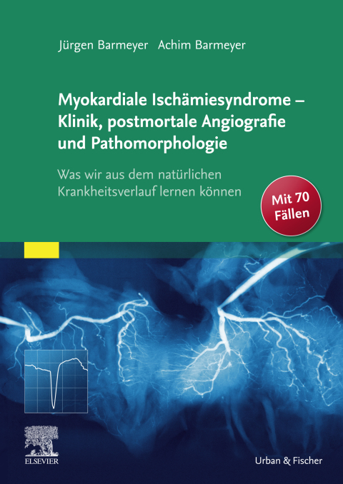 Cover image for book Die myokardialen Ischämiesyndrome - Klinik und postmortale Pathomorphologie