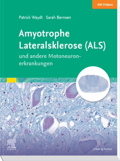 Amyotrophe Lateralsklerose (ALS) und andere Motoneuronerkrankungen 