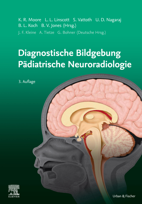 Diagnostic Imaging: PÃ¤diatrische Neuroradiologie 