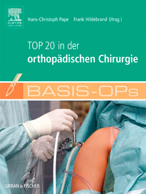 Cover image for book Basis OPs - Top 20 in der orthopädischen Chirurgie