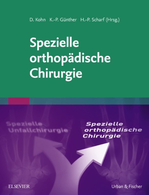 Cover image for book Spezielle orthopädische Chirurgie