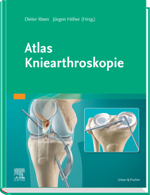 Cover image for book Atlas Kniearthroskopie