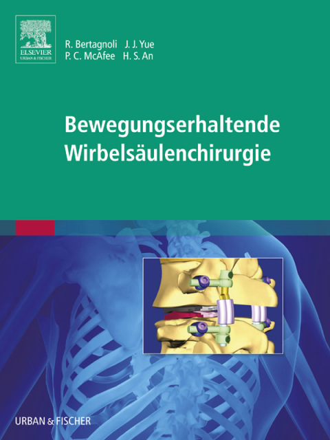 Bewegungserhaltende WirbelsÃ¤ulenchirurgie 