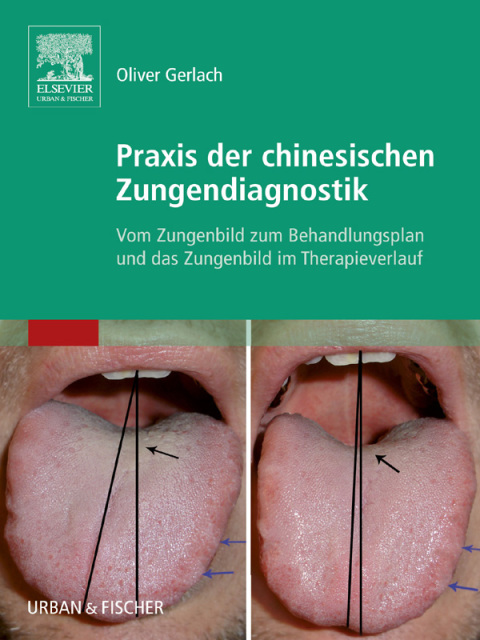 Cover image for book Praxis der chinesischen Zungendiagnostik