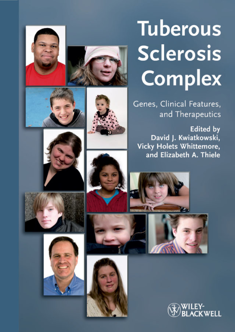 Cover image for book Tuberous Sclerosis Complex: Genes, Clinical Features and Therapeutics
