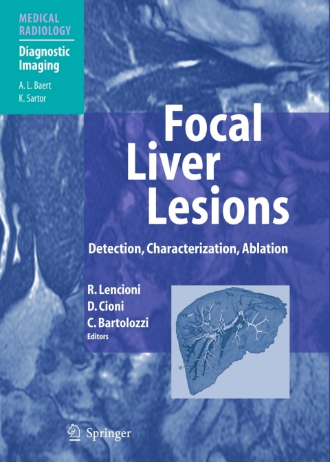 Cover image for book Focal Liver Lesions