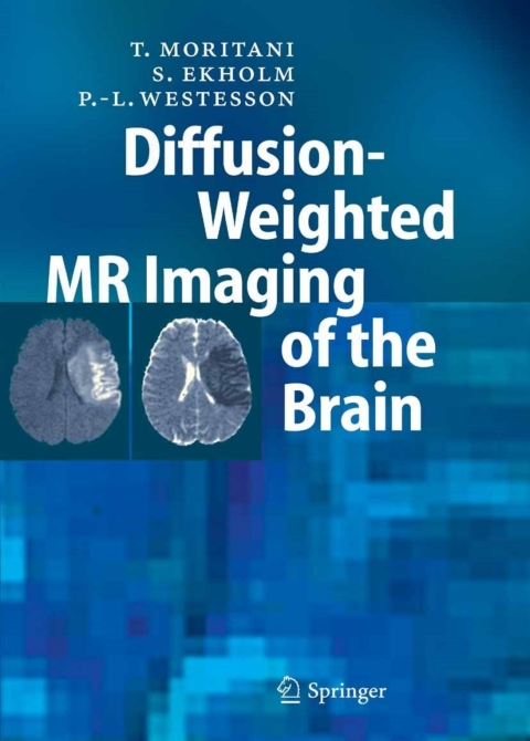 Cover image for book Diffusion-Weighted MR Imaging of the Brain