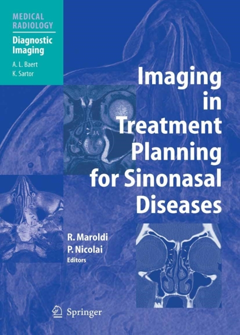 Cover image for book Imaging in Treatment Planning for Sinonasal Diseases