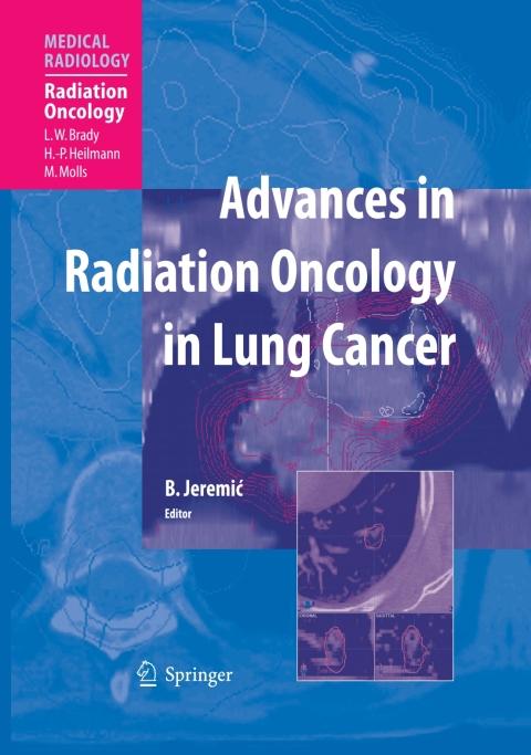 Cover image for book Advances in Radiation Oncology in Lung Cancer