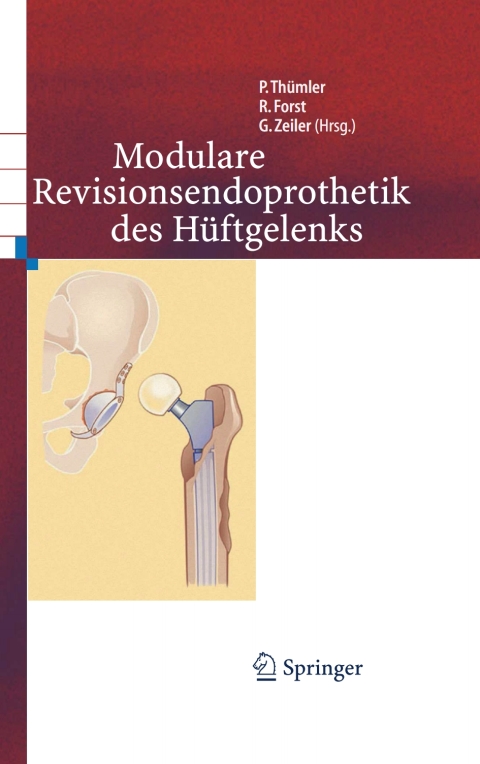 Cover image for book Modulare Revisionsendoprothetik des Hüftgelenks
