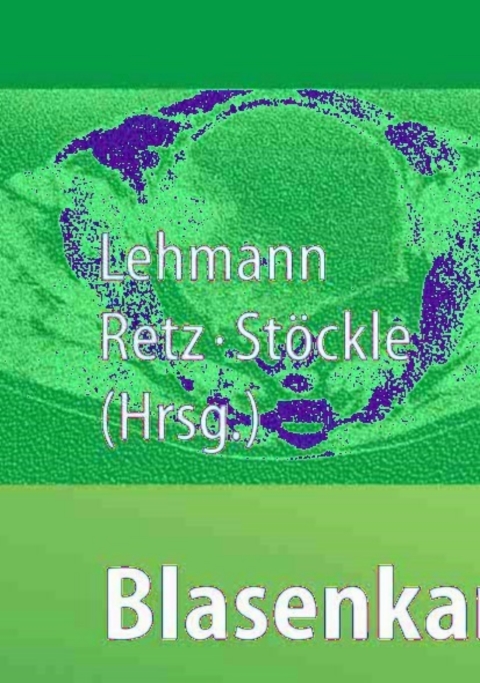 Cover image for book Blasenkarzinom