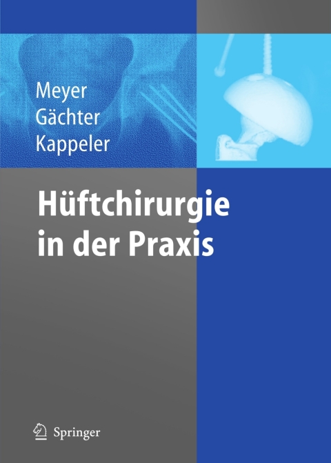 Cover image for book Hüftchirurgie in der Praxis