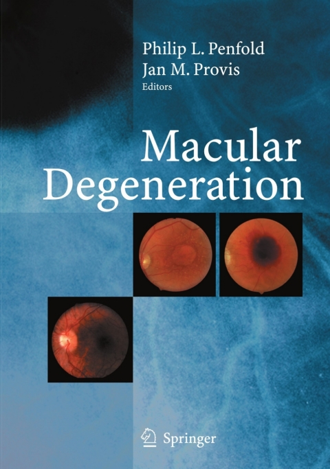 Cover image for book Macular Degeneration