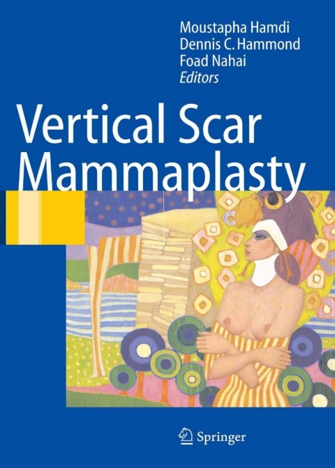 Vertical Scar Mammaplasty 