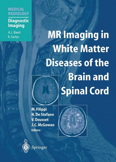 Cover image for book MR Imaging in White Matter Diseases of the Brain and Spinal Cord