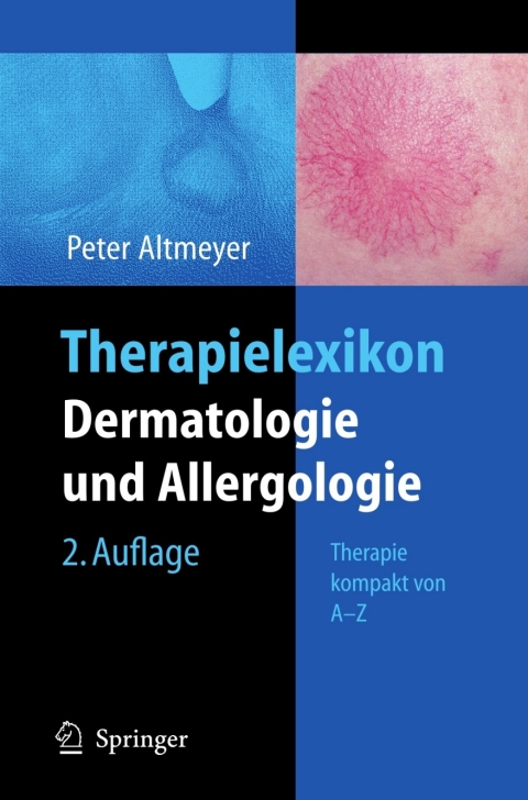 Cover image for book Therapielexikon Dermatologie und Allergologie