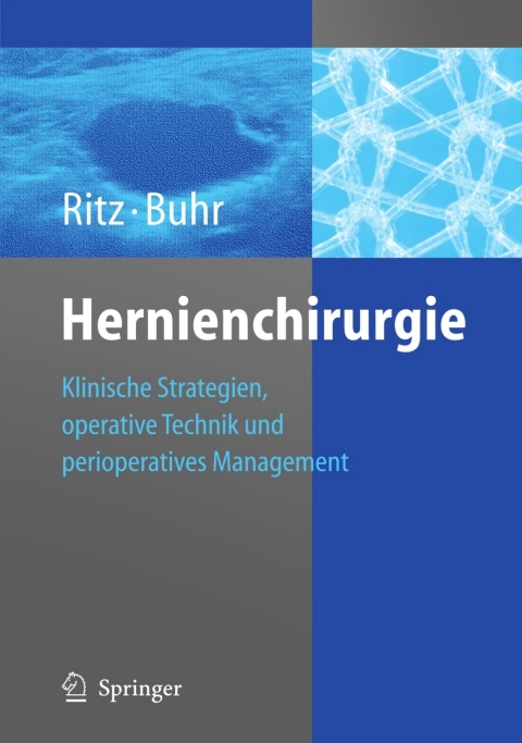 Cover image for book Hernienchirurgie