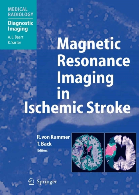 Cover image for book Magnetic Resonance Imaging in Ischemic Stroke