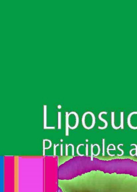 Cover image for book Liposuction