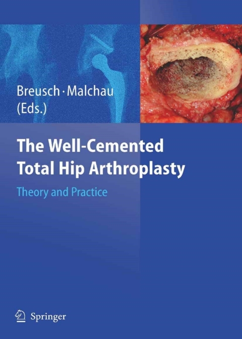 Cover image for book The Well-Cemented Total Hip Arthroplasty