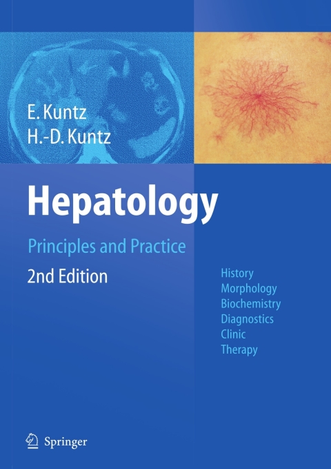 Cover image for book Hepatology, Principles and Practice