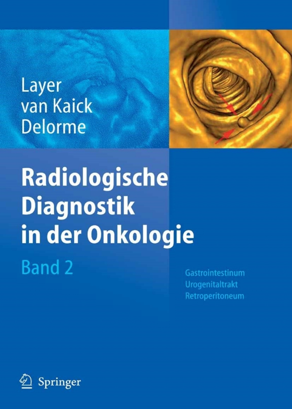 ISBN 9783540293187 product image for Radiologische Diagnostik in der Onkologie - 1st Edition (eBook Rental) | upcitemdb.com