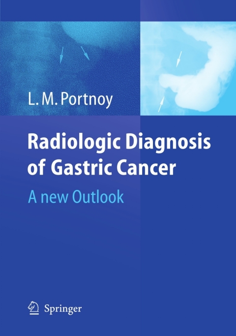 Cover image for book Radiologic Diagnosis of Gastric Cancer
