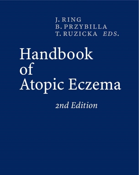Cover image for book Handbook of Atopic Eczema