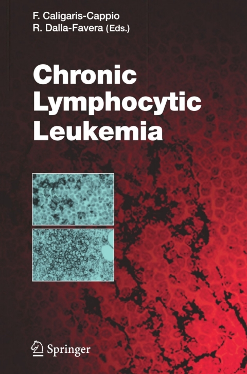 Cover image for book Chronic Lymphocytic Leukemia