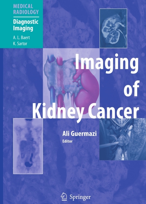 Cover image for book Imaging of Kidney Cancer