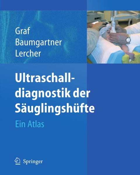 Ultraschalldiagnostik der SÃ¤uglingshÃ¼fte 